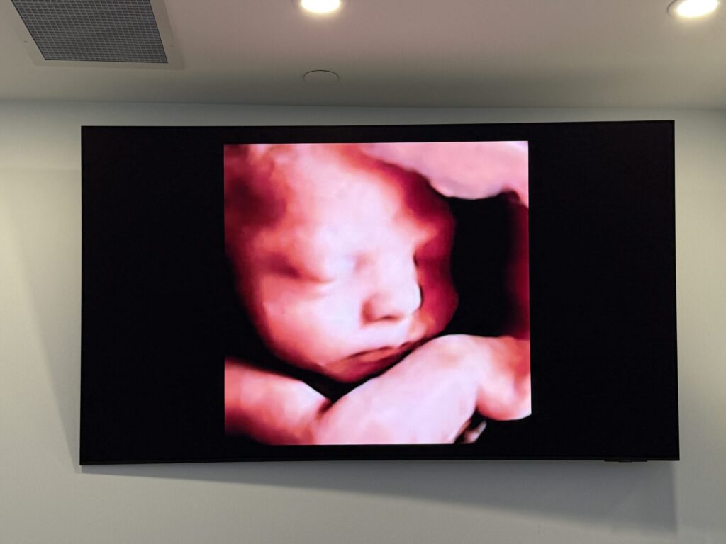 img 2694 scaled 2.jpg